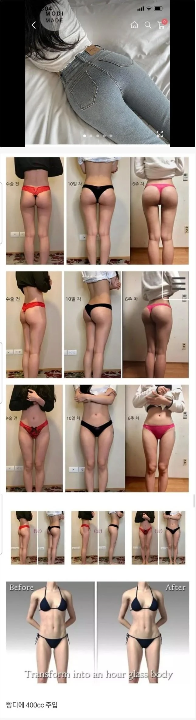 요즘 여자들이 갈수록 많이하는 수술